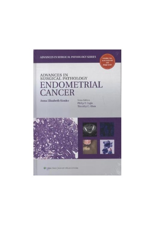 Advances in Surgical Pathology Endometrial Carcinoma
