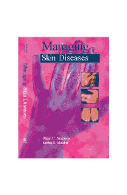 Managing Skin Diseases
