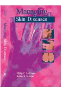 Managing Skin Diseases