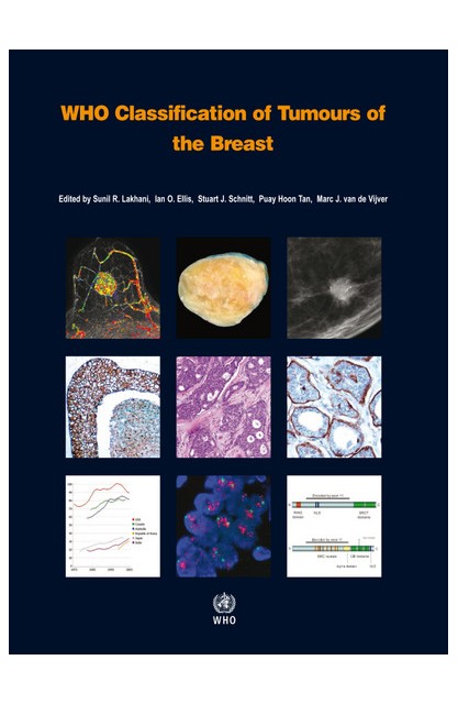 WHO Classification of...
