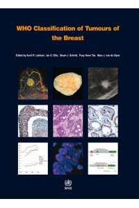 WHO Classification of Tumours of the Breast 4e