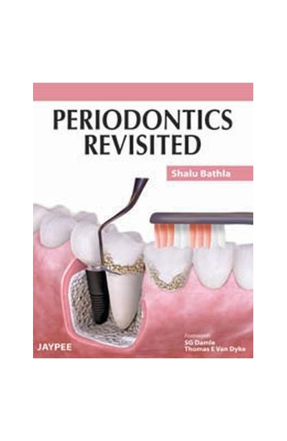 Periodontics Revisited