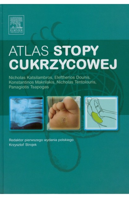 Atlas stopy cukrzycowej