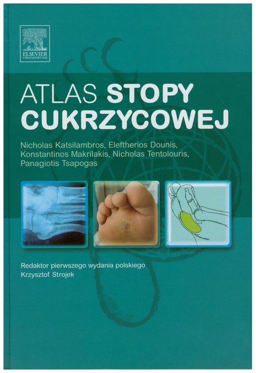 Atlas stopy cukrzycowej