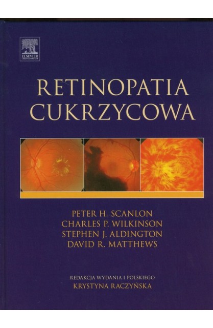 Retinopatia cukrzycowa