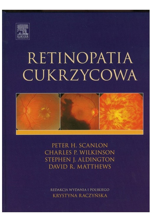 Retinopatia cukrzycowa