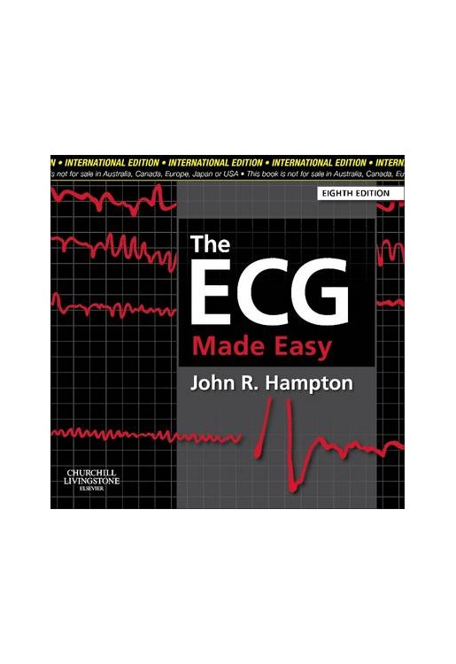 The ECG Made Easy