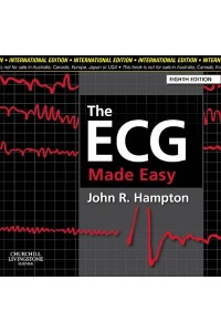 The ECG Made Easy