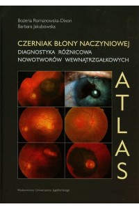 Czerniak błony naczyniowej Diagnostyka różnicowa nowotworów wewnątrzgałkowych