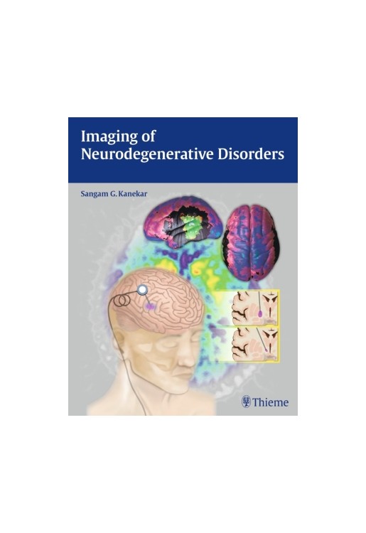 Imaging of Neurodegenerative Disorders