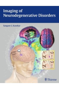Imaging of Neurodegenerative Disorders