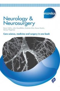 Eureka: Neurology & Neurosurgery