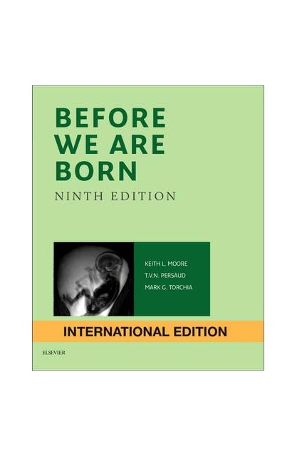 Before We are Born