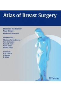Atlas of Breast Surgery