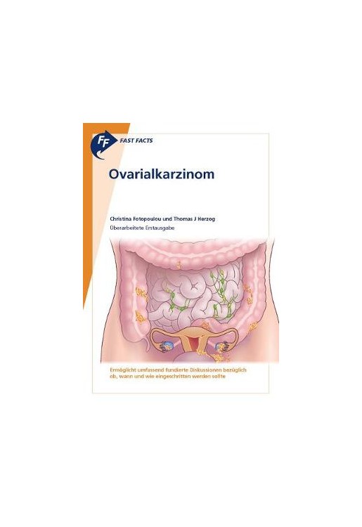 Fast Facts: Ovarialkarzinom