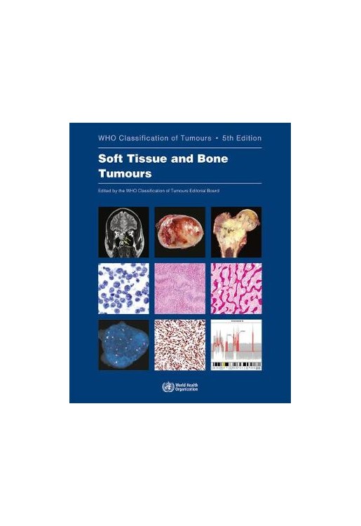 Soft Tissue and Bone Tumours, WHO Classification of Tumours. Fifth Edition