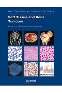 Soft Tissue and Bone Tumours, WHO Classification of Tumours. Fifth Edition