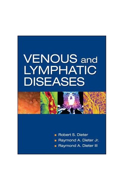 Venous and Lymphatic Diseases