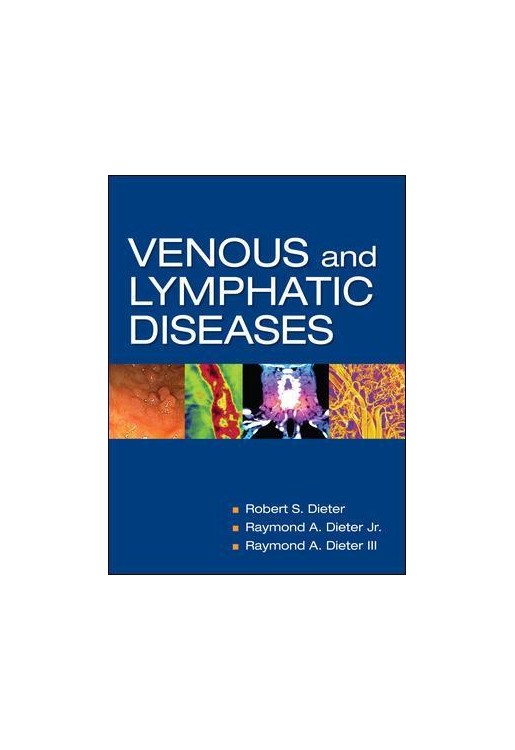 Venous and Lymphatic Diseases