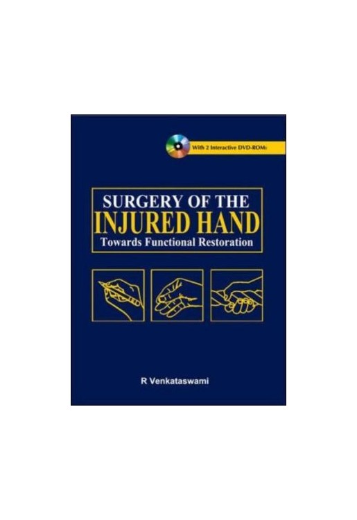 Surgery of the Injured Hand