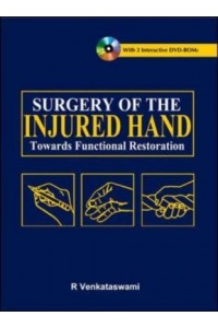 Surgery of the Injured Hand
