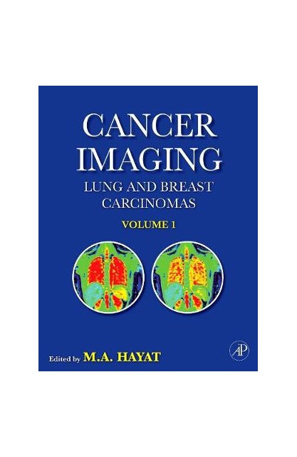 Cancer Imaging vol 1 Lung &...
