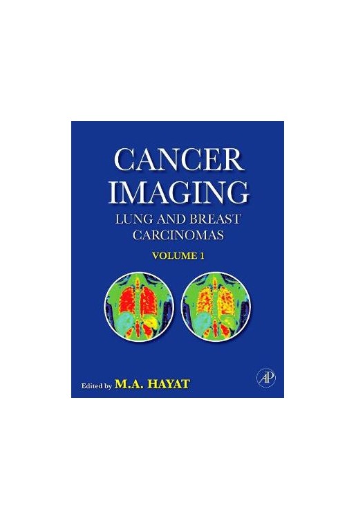 Cancer Imaging vol 1 Lung & Breast Cracinomas