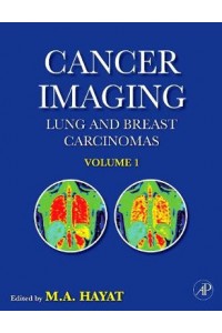 Cancer Imaging vol 1 Lung & Breast Cracinomas