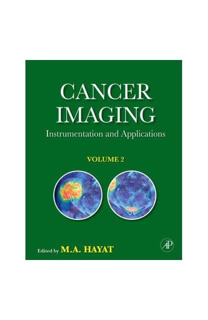Cancer Imaging v 2