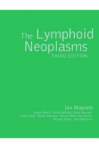Lymphoid Neoplasms 3e