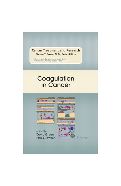 Coagulation in Cancer