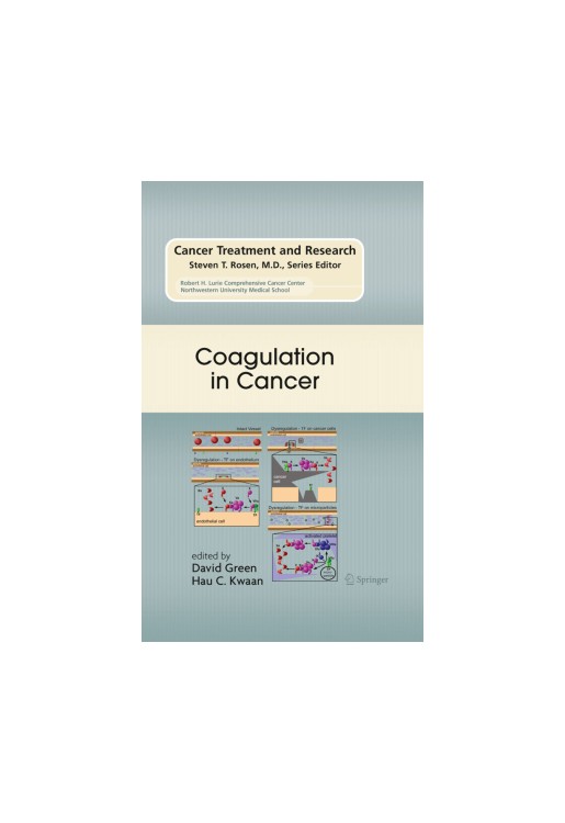 Coagulation in Cancer