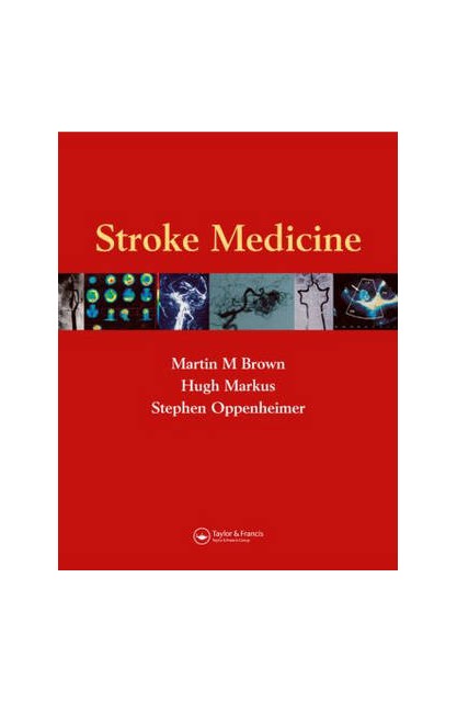 Stroke Medicine