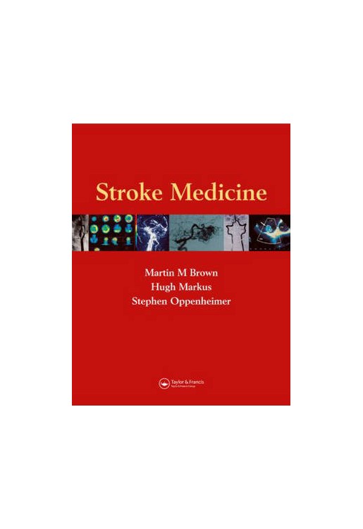 Stroke Medicine