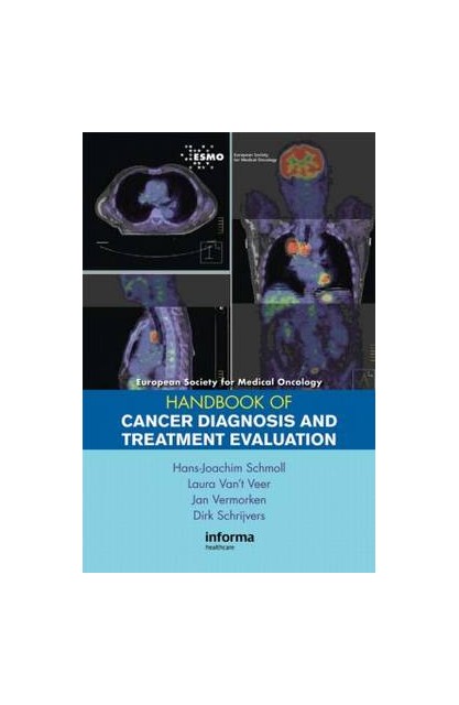 Esmo Handbook on Treatment...