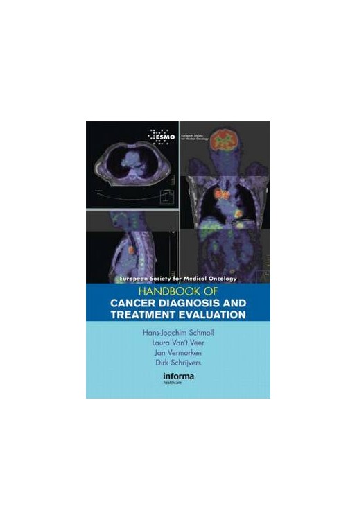 Esmo Handbook on Treatment Evaluation in Cancer