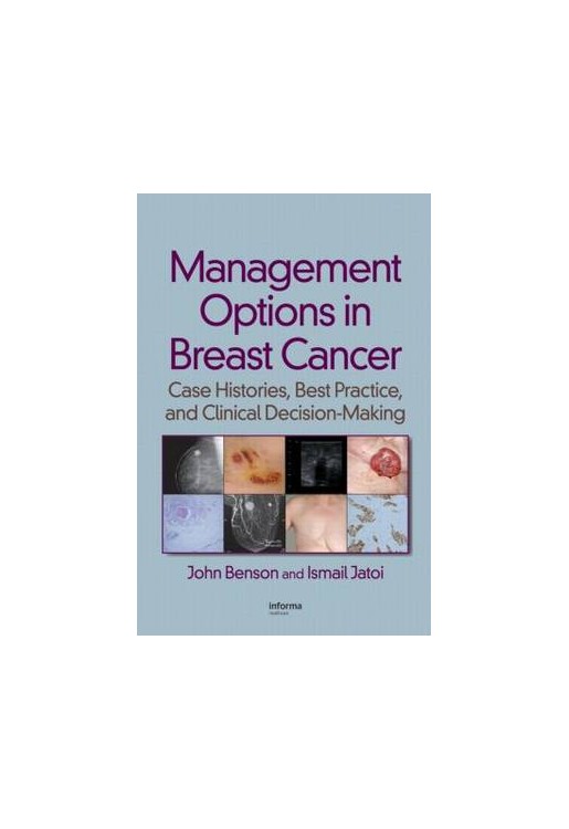 Management Options in Breast Cancer