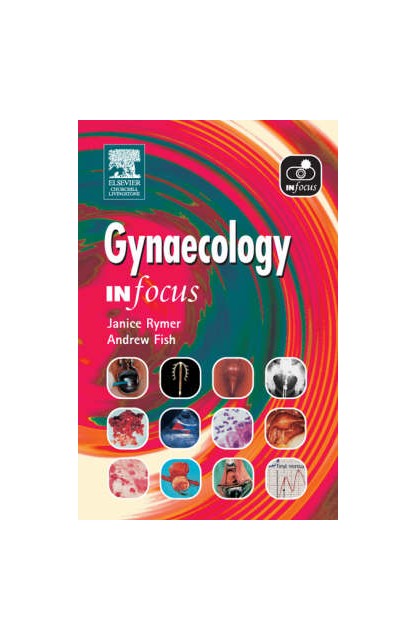 Gynaecology In Focus