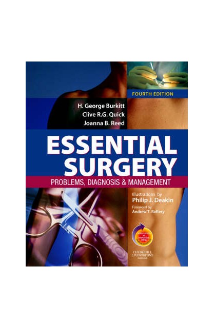 Essential Surgery 4e