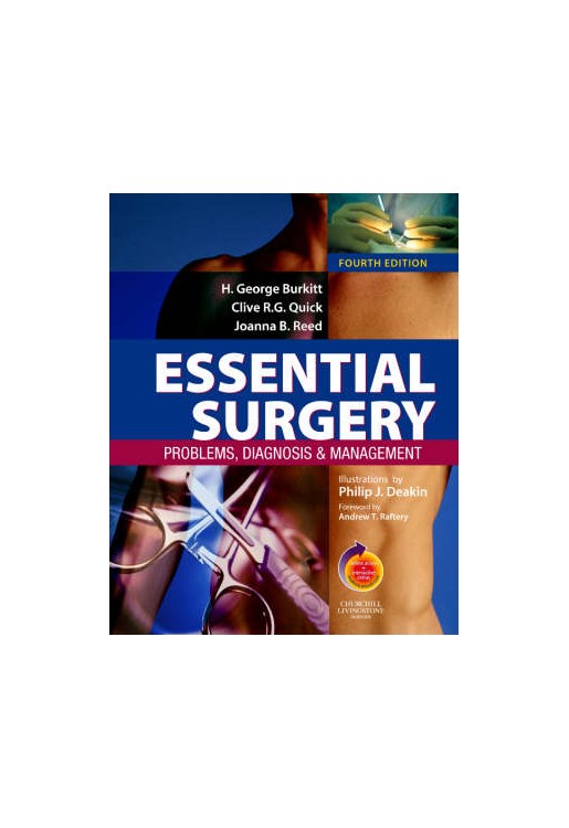 Essential Surgery 4e