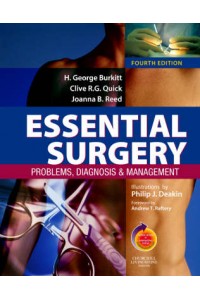 Essential Surgery 4e