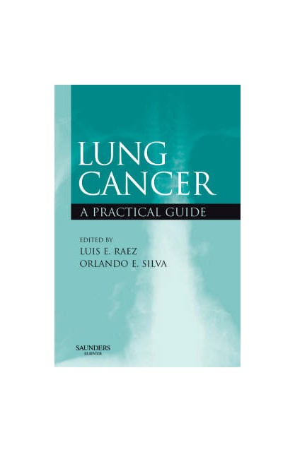 Lung Cancer