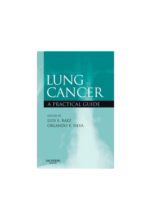 Lung Cancer
