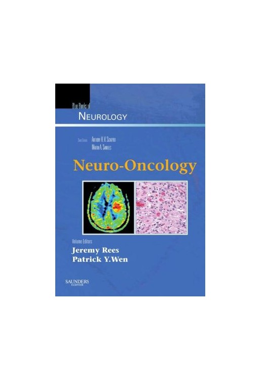 Neuro-Oncology