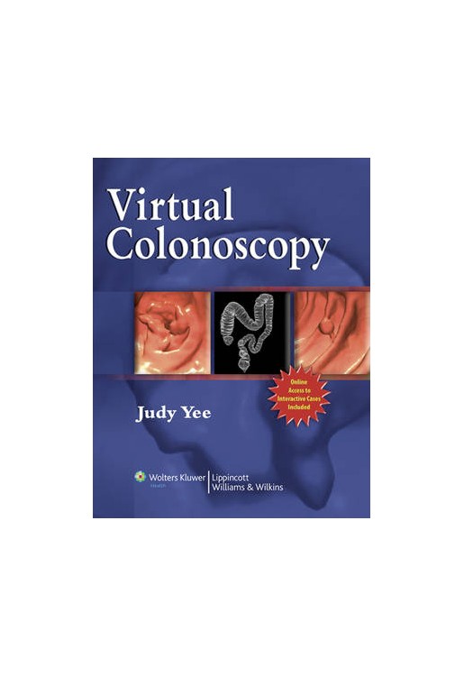 Virtual Colonoscopy