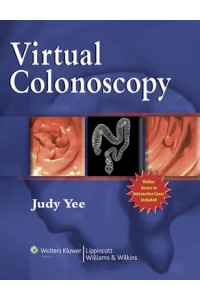 Virtual Colonoscopy