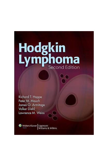 Hodgkin Lymphoma