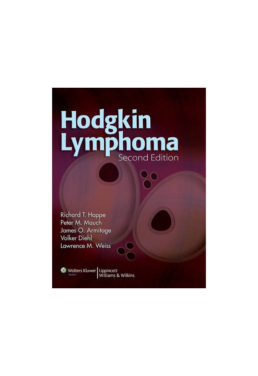 Hodgkin Lymphoma