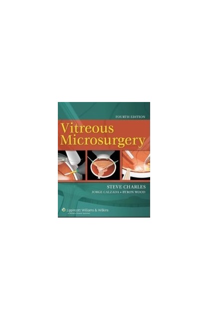 Vitreous Microsurgery