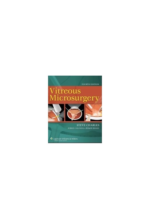 Vitreous Microsurgery